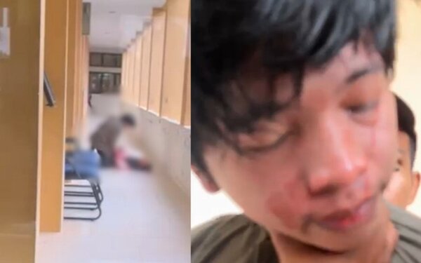 Mahasiswa UIN Dibacok di Kampus Suska Riau Diduga Karena Motif Asmara